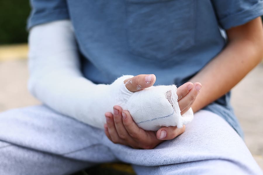 A worker with a broken arm, representing the importance of general liability insurance and workers' compensation coverage during a roofing project to protect homeowners from injury-related costs.